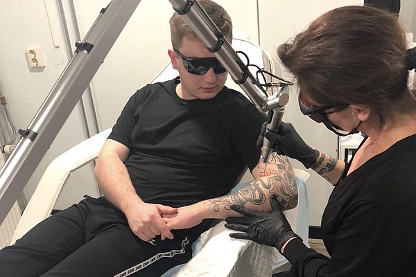 tattoo verwijderen laser